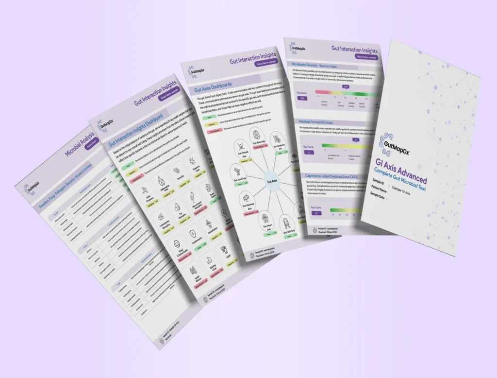 gi axis advanced reports mockup new
